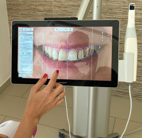 Imagen de Escaner con diseño de sonrisa