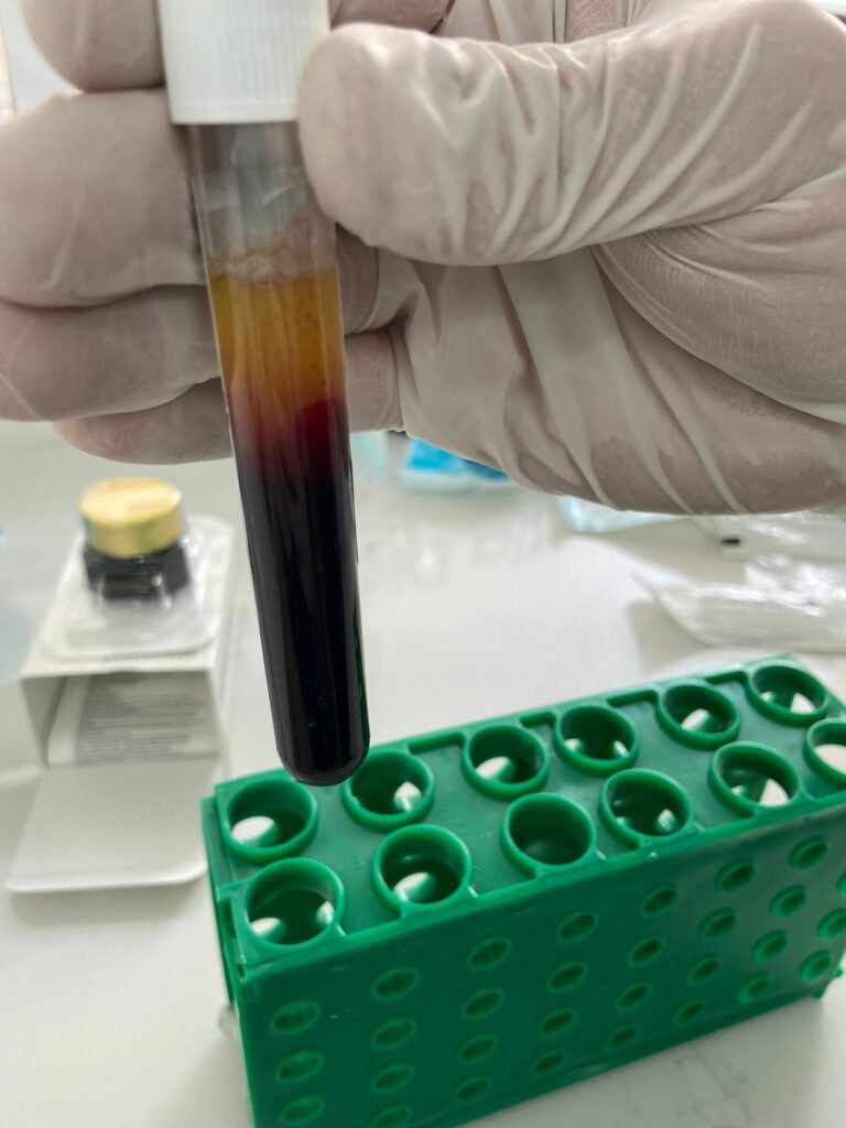 Muestra de sangre separada Imagen de Muestra de sangre separada