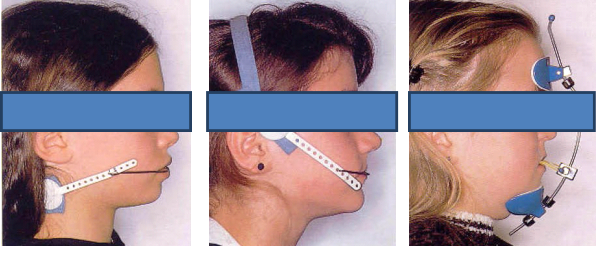 Imagen de Ortodoncia niñas